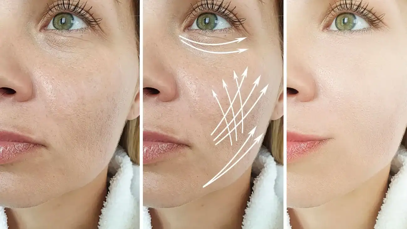 Can One Treatment Really Tackle More Than One Skin Concern Sutton?