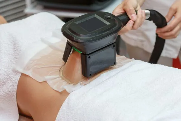 Image of person having fat freezing treatment to help weight gain Sutton