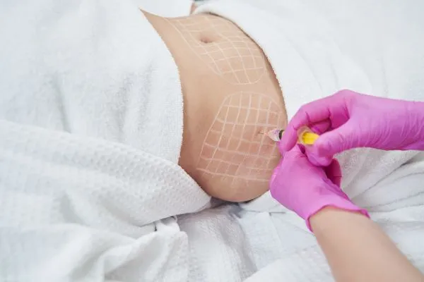image of fat dissolving injections on love handles to help combat weight gain Sutton