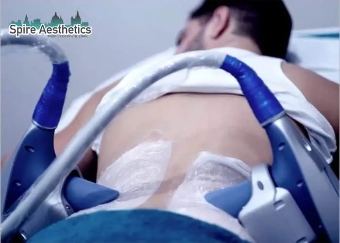 Man having fat freezing treatment done on love handles before a competitions Sutton to create a sculpted look.