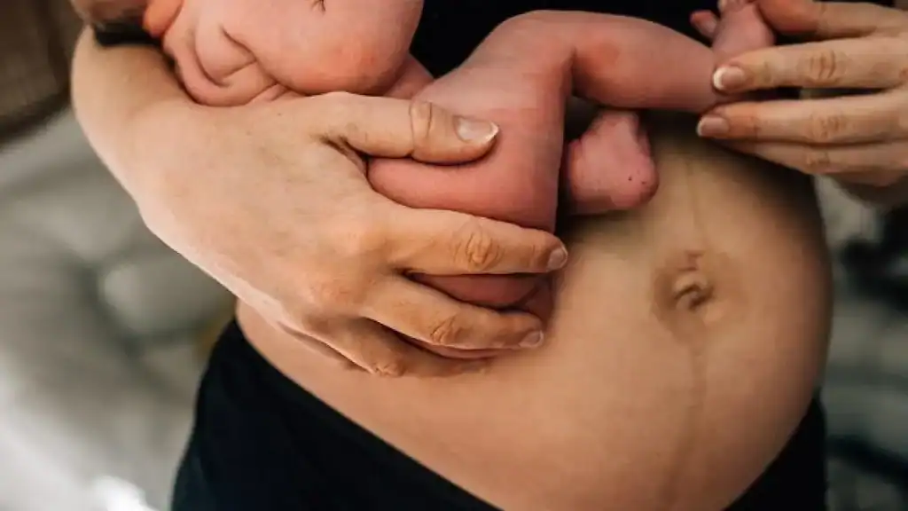 Why Is My Stomach Still Big After Pregnancy Sutton?